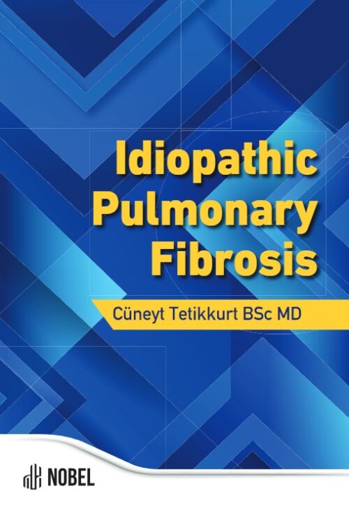 Idiopathic Pulmonary Fibrosis